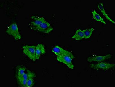 LIMS1 Antibody