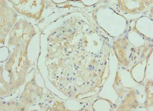 LIMS1 Antibody