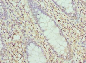 LIMS1 Antibody