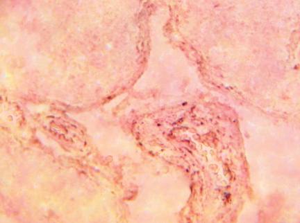 Rabbit Human MGMT Antibody