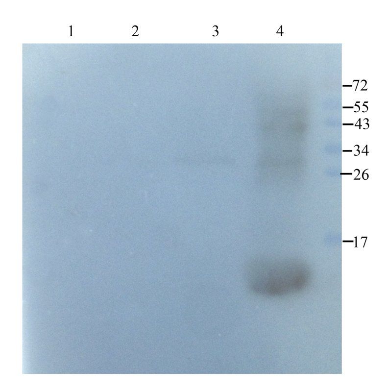 Neutrophil Elastase Rabbit Polyclonal Antibody