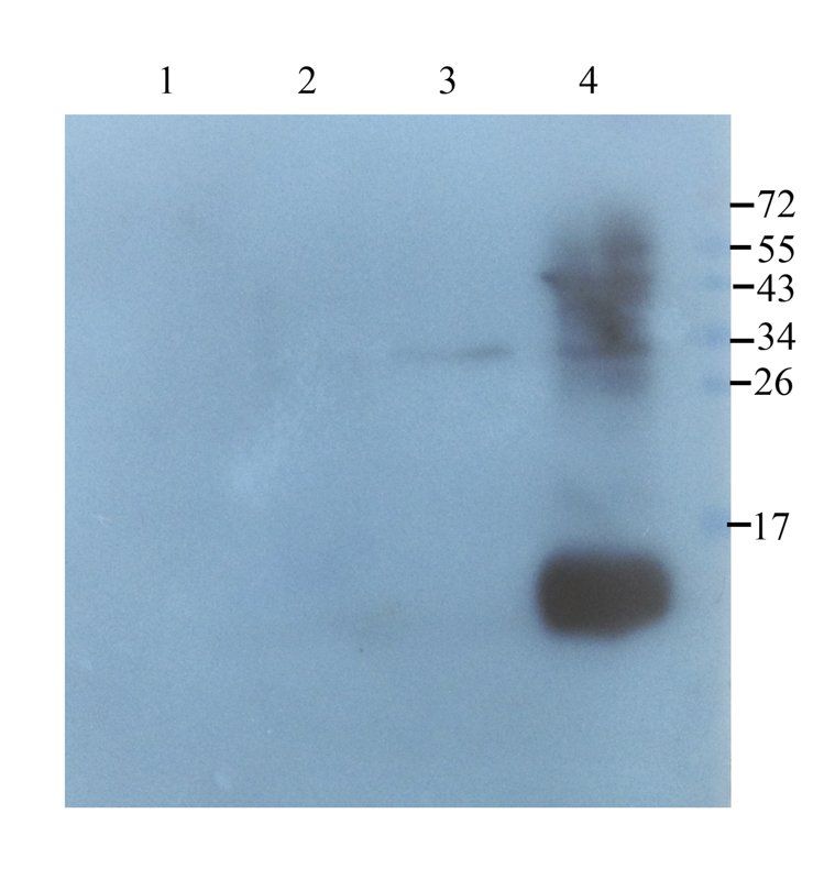 Neutrophil Elastase Rabbit Polyclonal Antibody