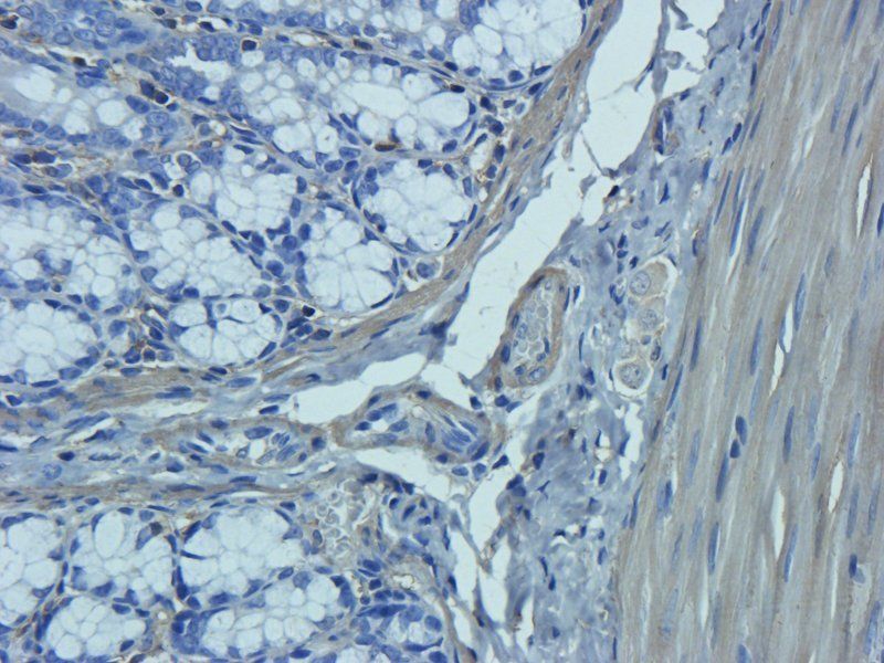 Neutrophil Elastase Rabbit Polyclonal Antibody