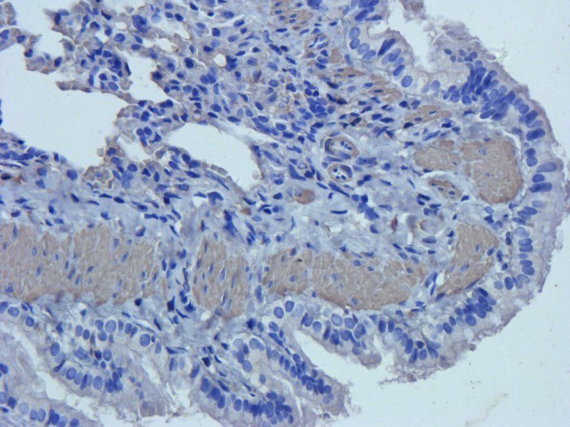 Neutrophil Elastase Rabbit Polyclonal Antibody