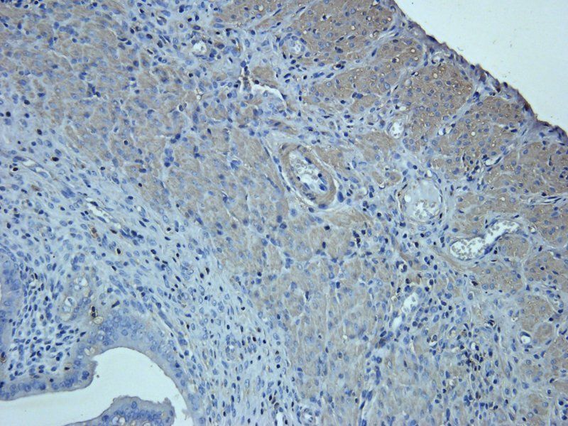 Neutrophil Elastase Rabbit Polyclonal Antibody
