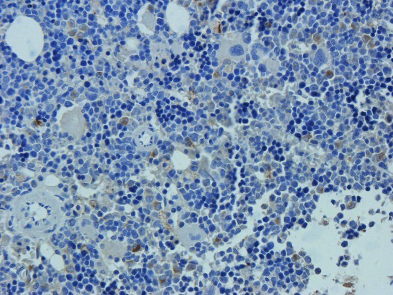 Neutrophil Elastase Rabbit Polyclonal Antibody