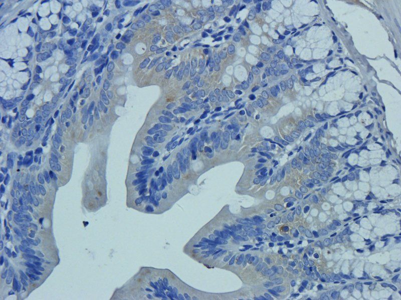 Neutrophil Elastase Rabbit Polyclonal Antibody