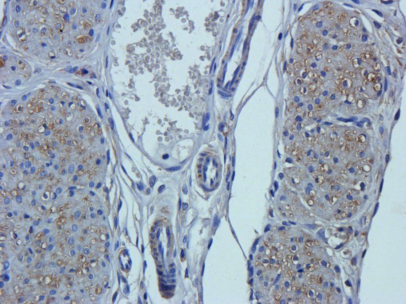 Neutrophil Elastase Rabbit Polyclonal Antibody