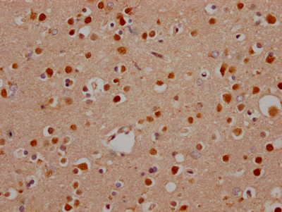 NOTCH1 Antibody