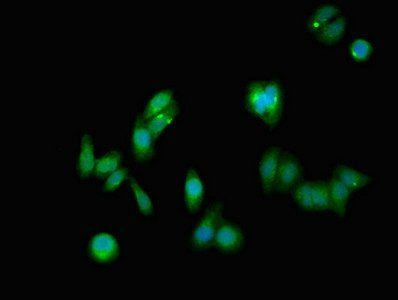 NOTCH1 Antibody