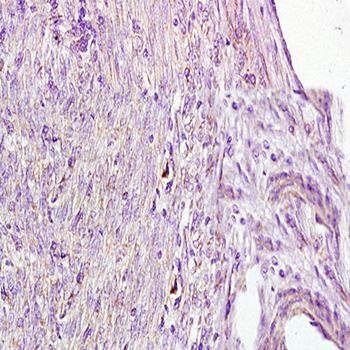 AFP Mouse Monoclonal Antibody (Biotin)