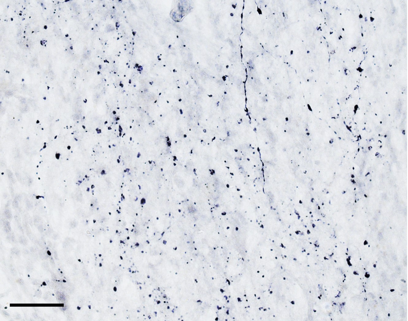 TPH2 (aa16-29) Antibody