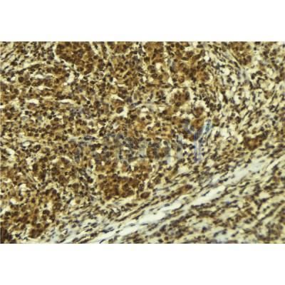 Phospho-ATR (Ser428) Antibody