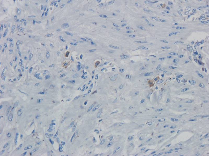 PAX6 Rabbit Polyclonal Antibody