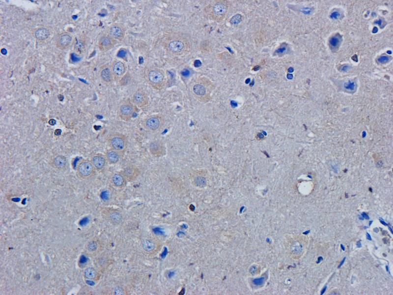 PAX6 Rabbit Polyclonal Antibody