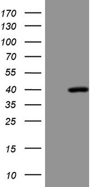 PDGF Receptor alpha Antibody