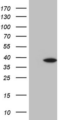 PDGF Receptor alpha Antibody