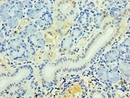 PDGFD Antibody