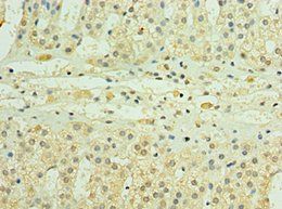PDGFD Antibody