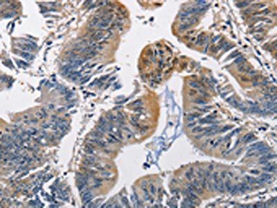 PGK1 Antibody
