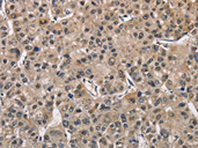 PGK1 Antibody
