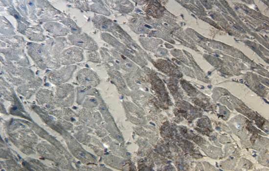 CD206 Rabbit Polyclonal Antibody