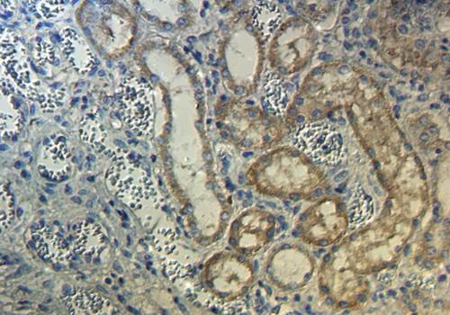 CD206 Rabbit Polyclonal Antibody