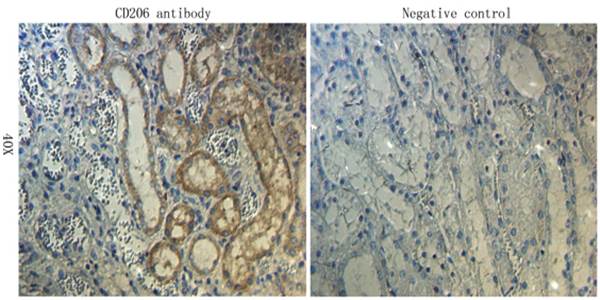 CD206 Rabbit Polyclonal Antibody