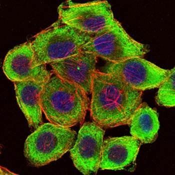 PINCH Antibody