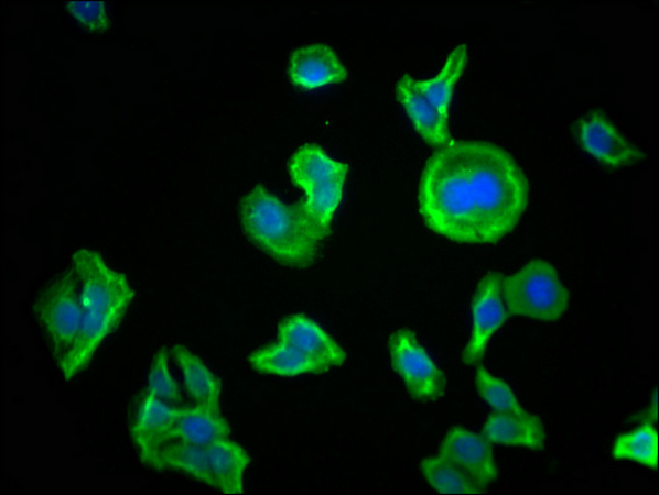 PKM Antibody
