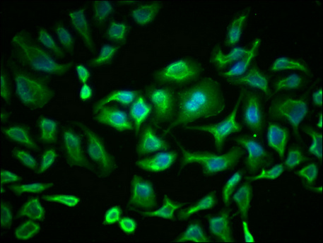 PKM Antibody