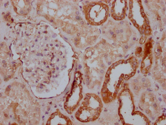 PKM Antibody