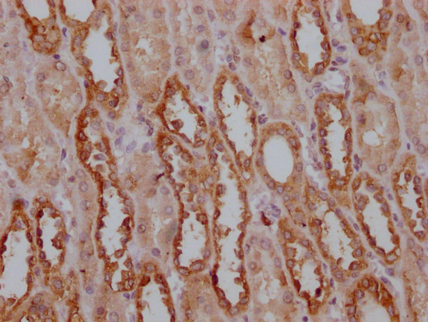 PKM Antibody