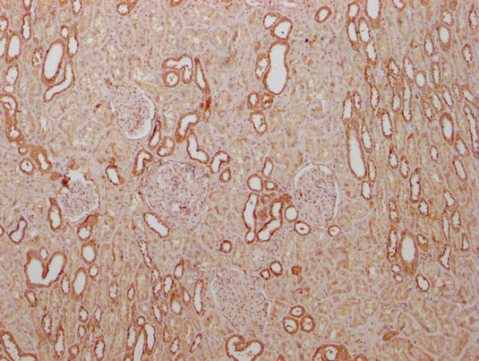 PKM Antibody