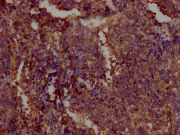 PKM Antibody