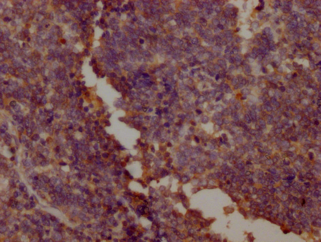 PKM Antibody