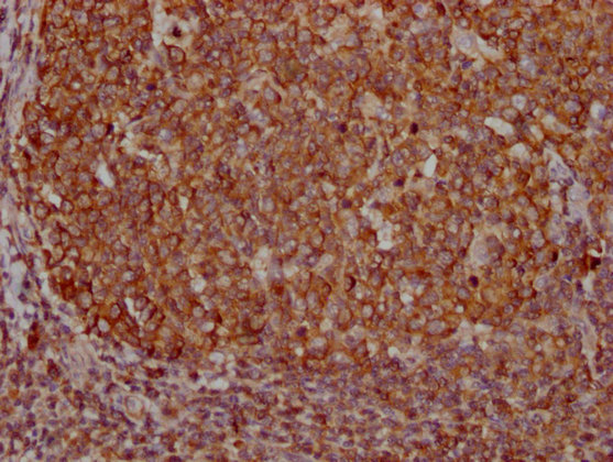 PKM Antibody