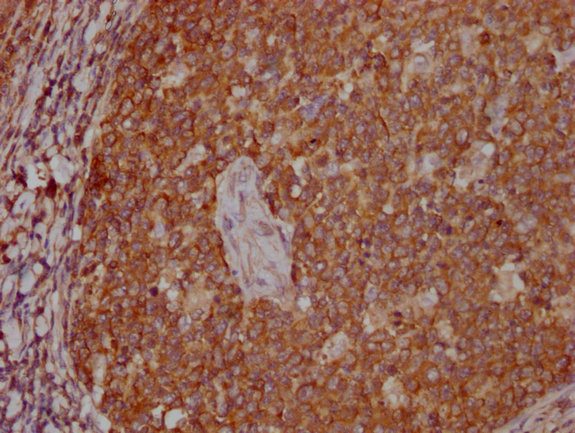 PKM Antibody