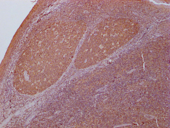 PKM Antibody