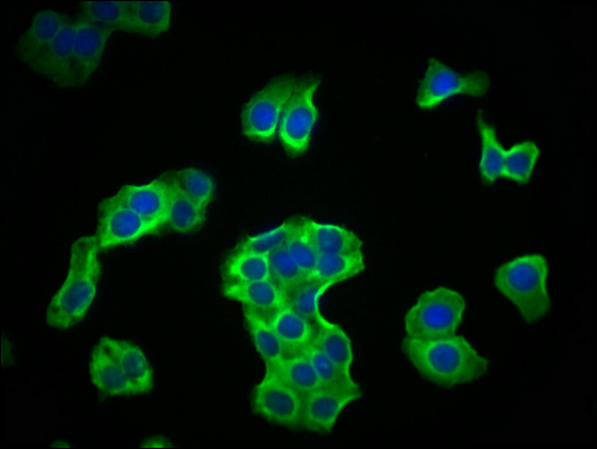 PKM Antibody