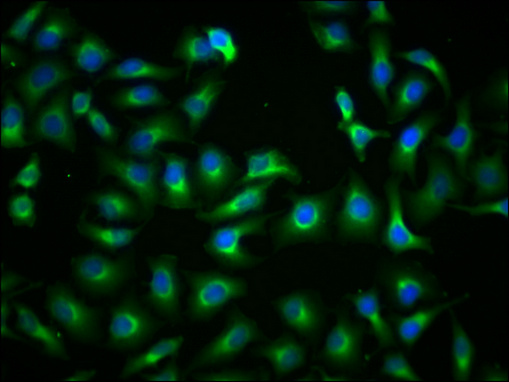PKM Antibody