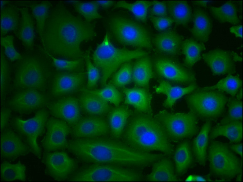 PKM Antibody