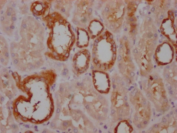 PKM Antibody