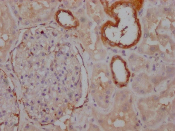 PKM Antibody