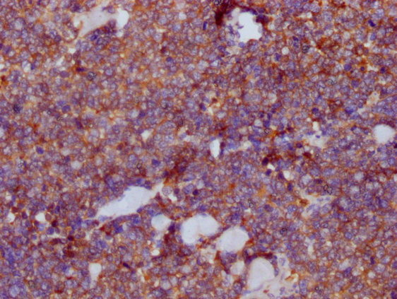 PKM Antibody