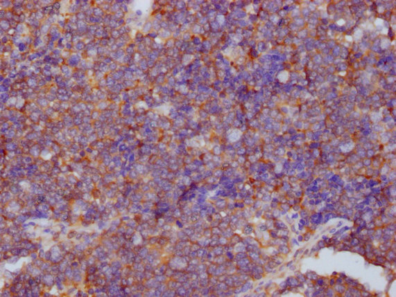 PKM Antibody