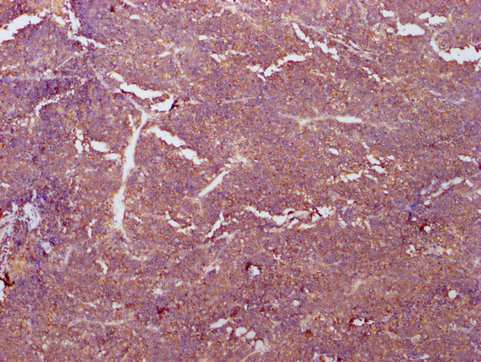 PKM Antibody