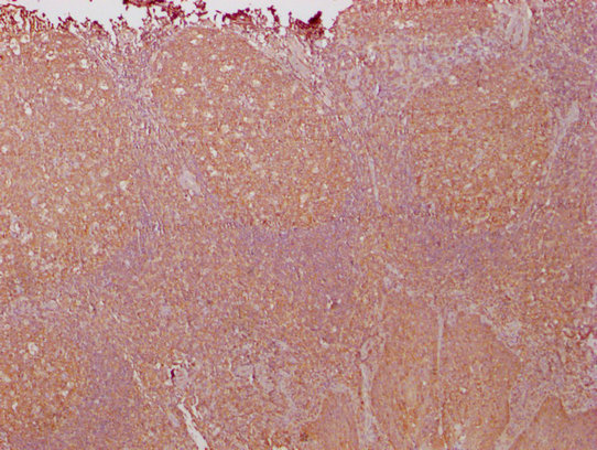 PKM Antibody