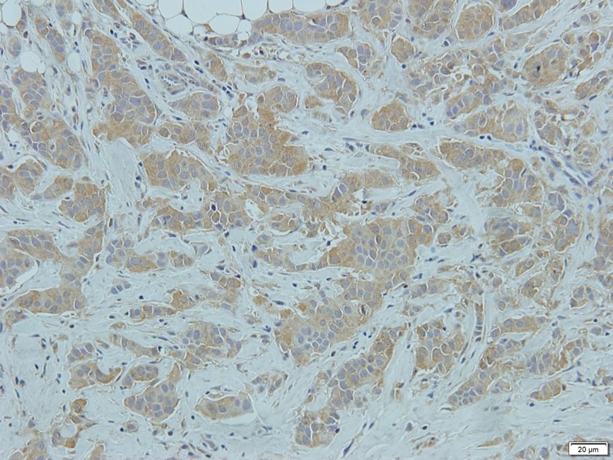 RANK Rabbit Polyclonal Antibody