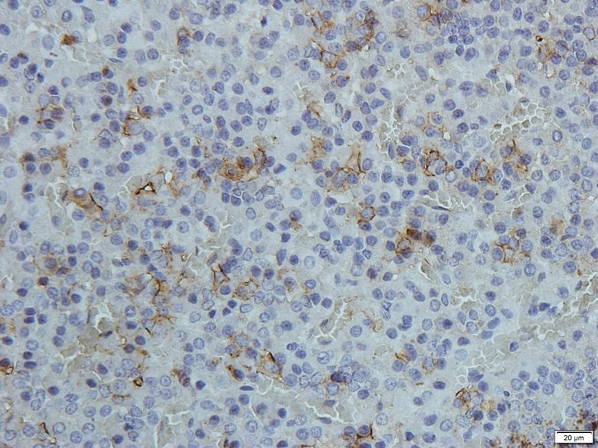 RANK Rabbit Polyclonal Antibody